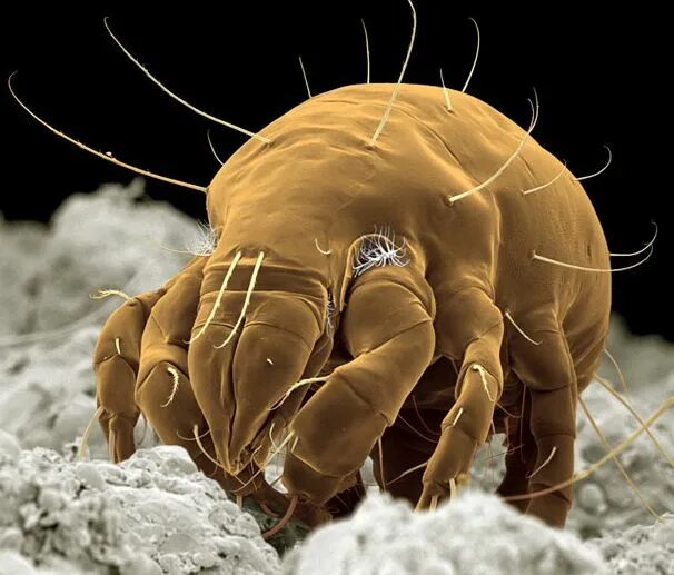 Постельные пылевые клещи фото Des insectes au microscope électronique Electron microscope, Insect photography,