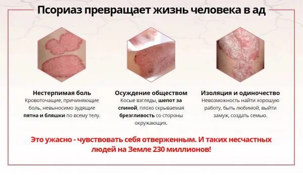 Постскабиозный дерматит фото и описание Красота кожного покрова с psorix купить по цене 1149 ₽ в Москве на PromPortal.Su