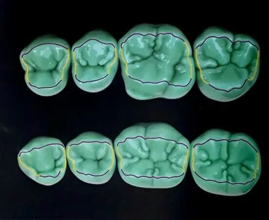 Поверхности зуба фото Pin de Rafaela Gch en anatomía y morfologia dental (con imágenes) Anatomía denta