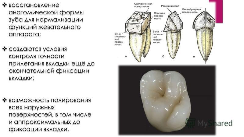Поверхности зуба фото Восстановление анатомической формы - найдено 79 фото