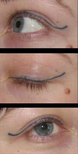 Повторный татуаж Как делают татуаж дешево - чем опасна "экономия"