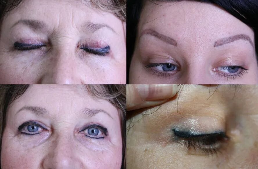 Повторный татуаж Перманентный макияж: обратная сторона медали PROFFLESSON Дзен