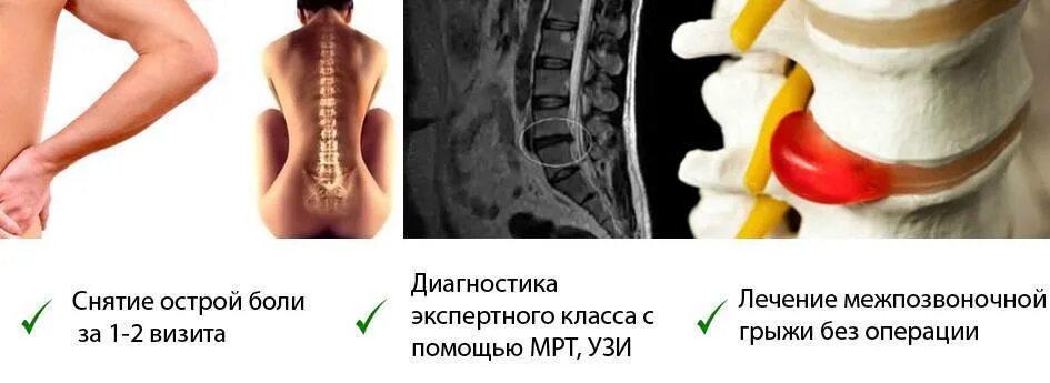 Поясничная грыжа симптомы и лечение фото Сколько больничный при грыже позвоночника - найдено 90 фото