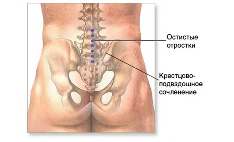 Пояснично крестцовый отдел фото У меня часто бывает боль в крестце: почему это происходит и можно ли вылечить до