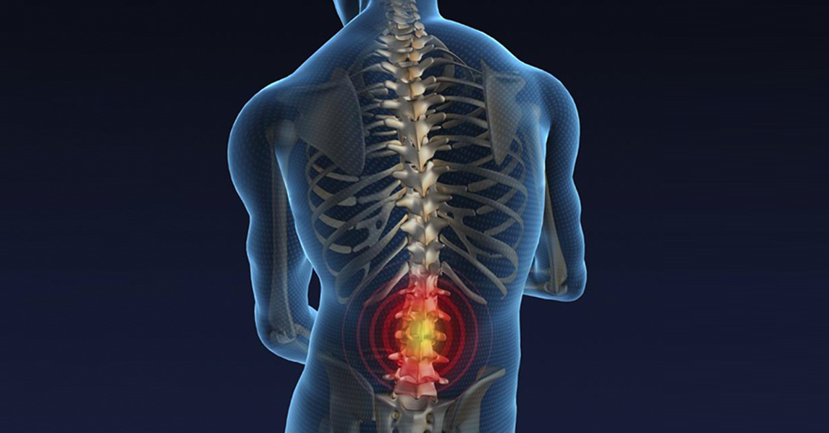 Пояснично крестцовый отдел фото на человеке The Degenerative Cascade Scottsdale, AZ Orthopedic Spine Surgery