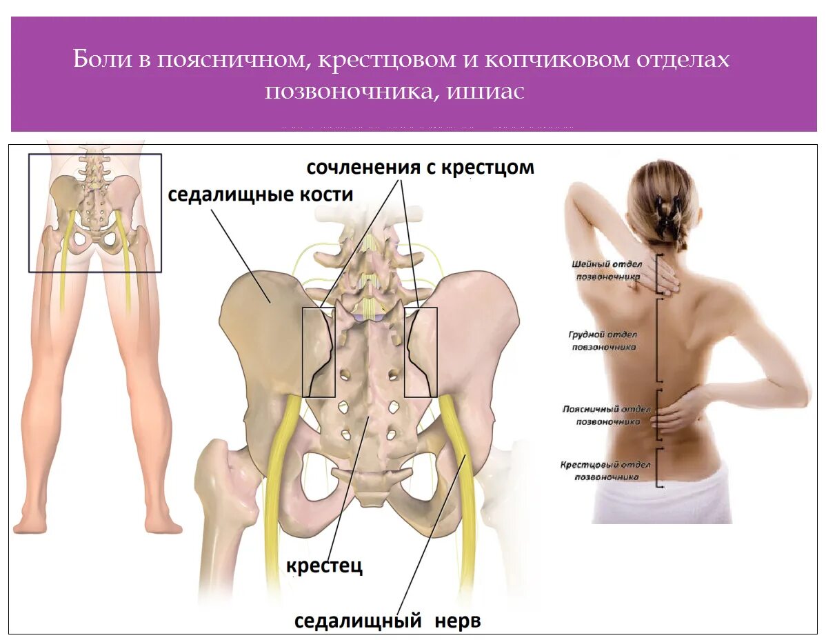 Пояснично крестцовый отдел фото на человеке Что делать при болях в крестцовом отделе позвоночника?. клиника бобыря