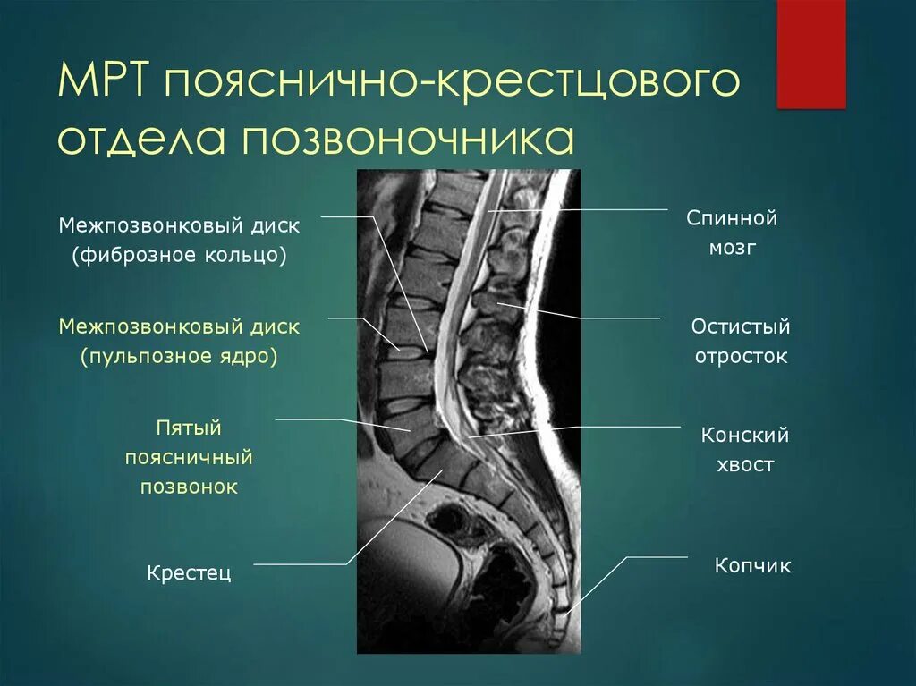 Пояснично крестцовый отдел позвоночника фото Подготовка к исследованию крестцового отдела позвоночника - найдено 82 картинок