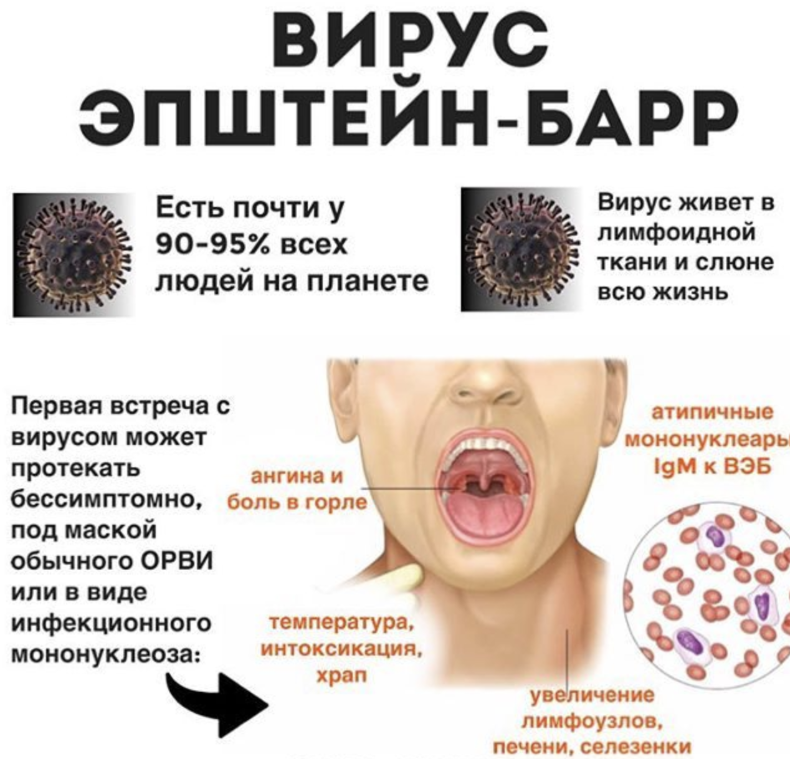 Поясничный герпес фото Вирус Эпштейна–Барра: в чем опасность и как помочь организму