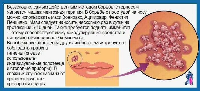 Поясничный герпес фото Antibiotics trigger herpes outbreak