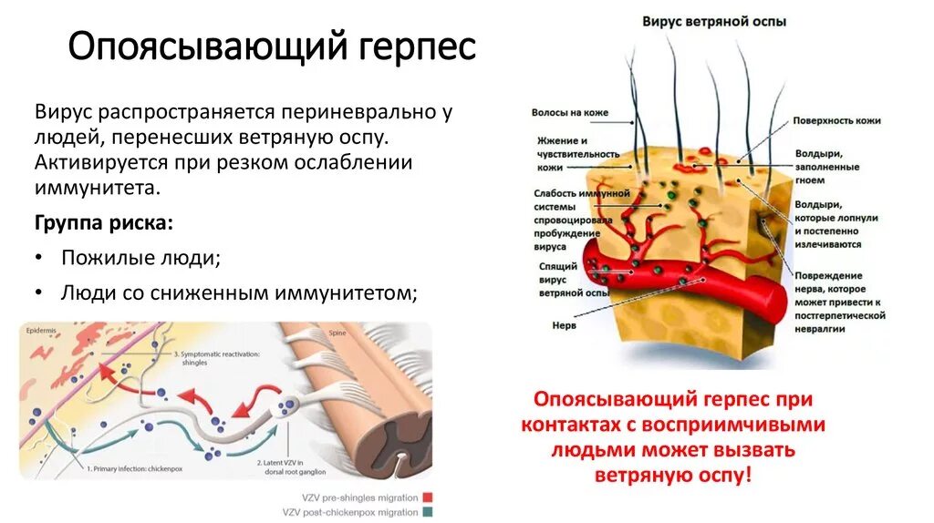 Поясничный герпес фото и лечение у мужчин Картинки ПОРАЖАЮТ ЧУВСТВИТЕЛЬНЫЕ НЕРВНЫЕ ОКОНЧАНИЯ СЛИЗИСТЫХ ОБОЛОЧЕК