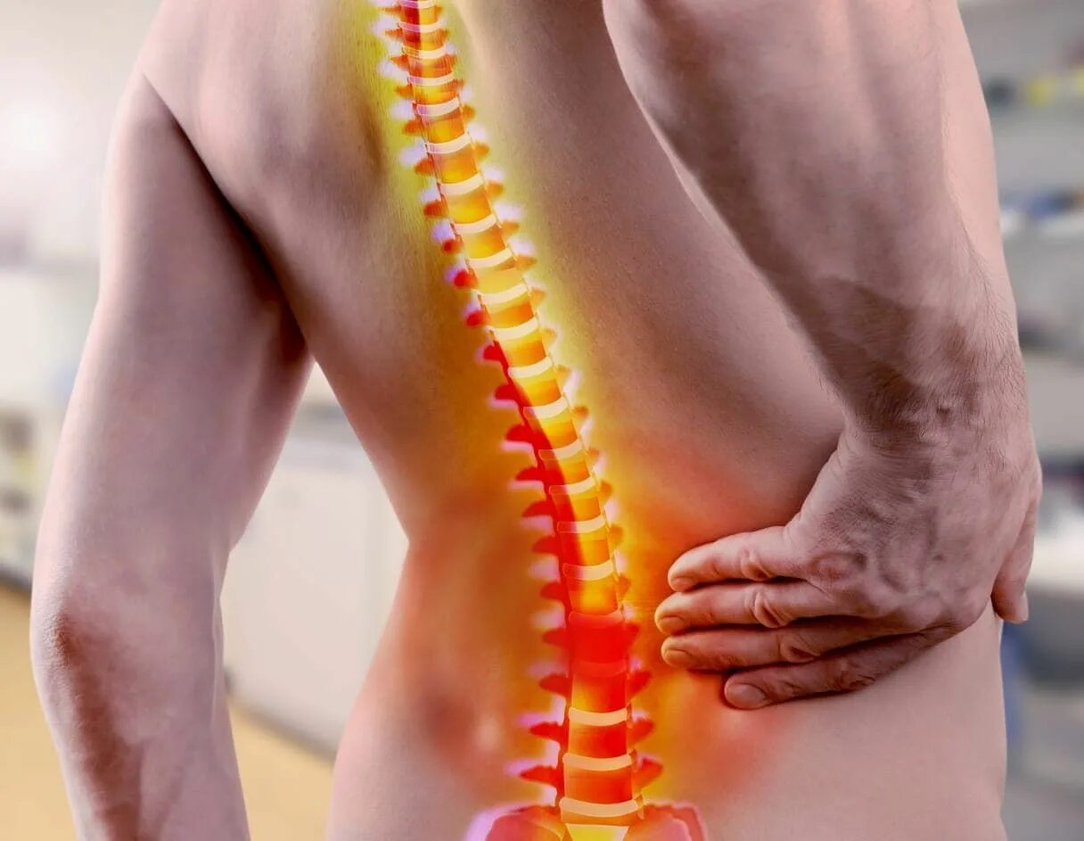 Поясничный отдел фото Os maiores vilões da Coluna Vertebral 1 Back pain, Severe back pain, Low back pa