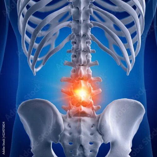 Поясничный отдел фото 3d rendered medically accurate illustration of a painful lumbar spine Иллюстраци