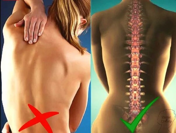 Поясничный отдел спины фото The invisible cause of our diseases - "settled" spine With age, human muscles be