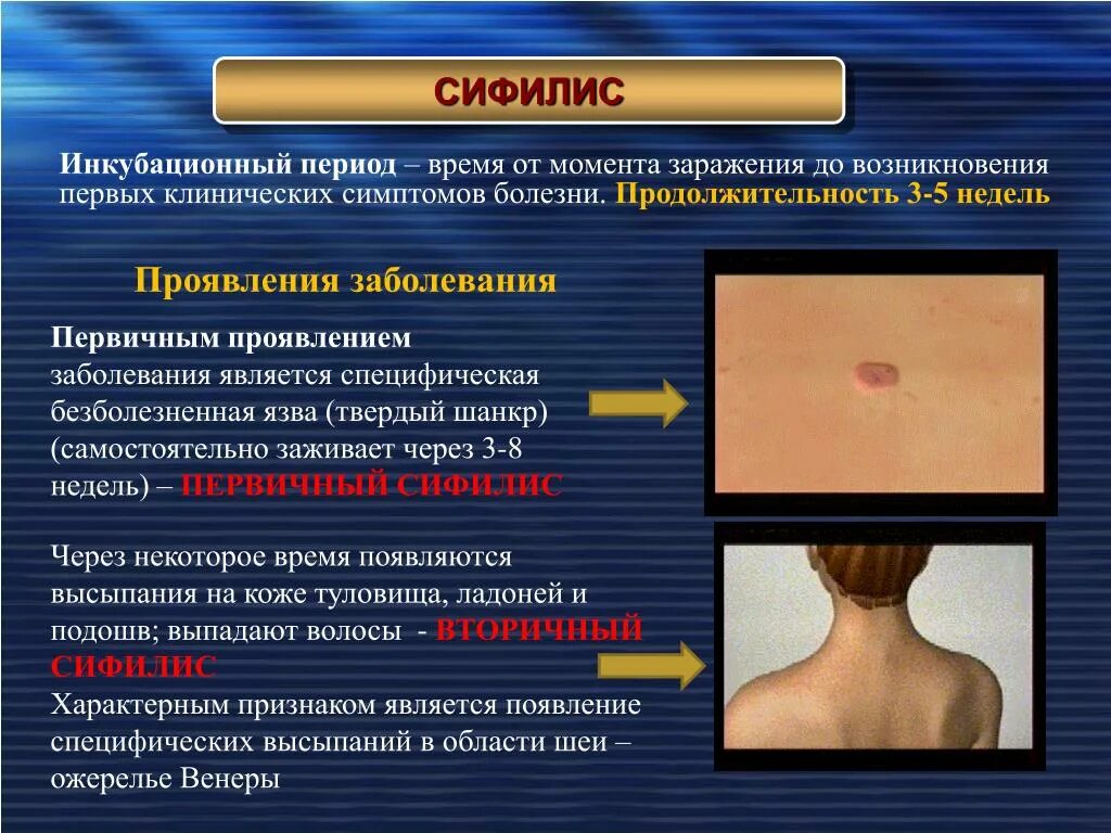 Поясной лишай у человека симптомы фото Через рану можно заразиться: найдено 77 картинок