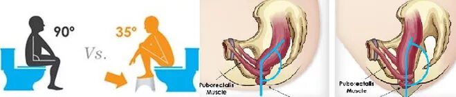 Поза орла при дефекации фото Как правильно сидеть на унитазе?