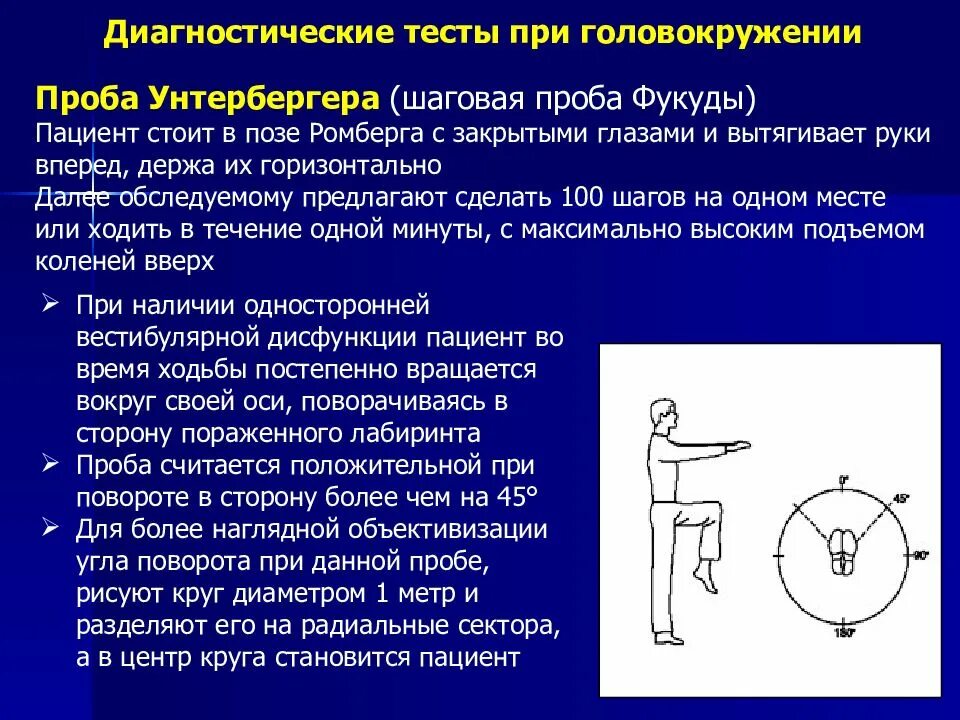 Поза ромберга что это такое фото Для каких целей применяется проба ромберга