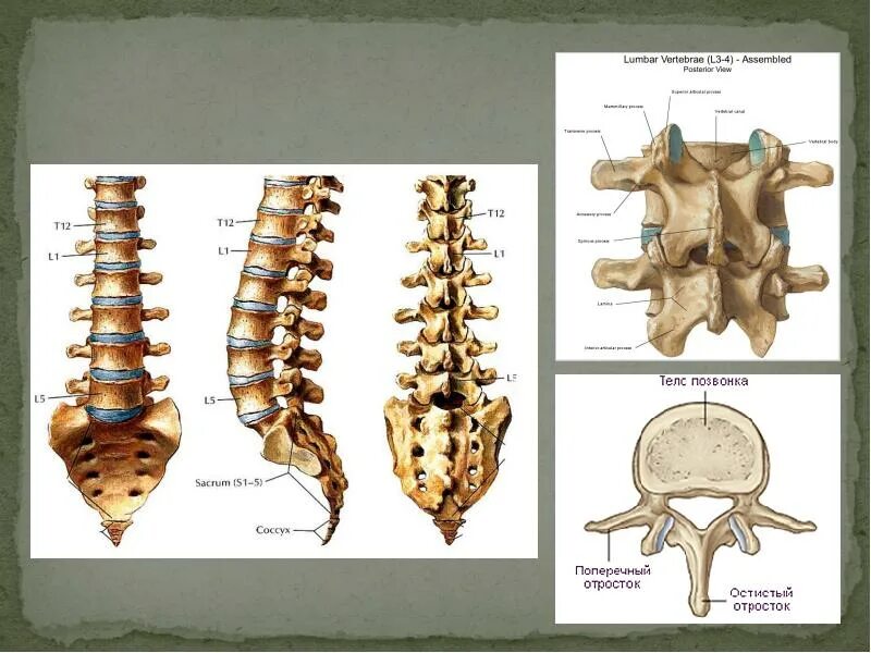 Позвонки поясничного отдела фото Картинки L 4 5 ПОЗВОНОК