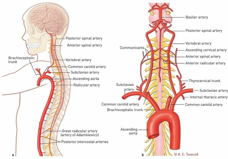 Позвоночная артерия анатомия схема расположения Vertebral artery, Carotid artery, Chest pain