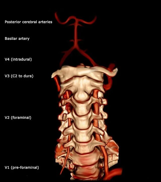 Позвоночная артерия анатомия схема расположения File:Vertebral artery 3D AP.jpg - Wikipedia