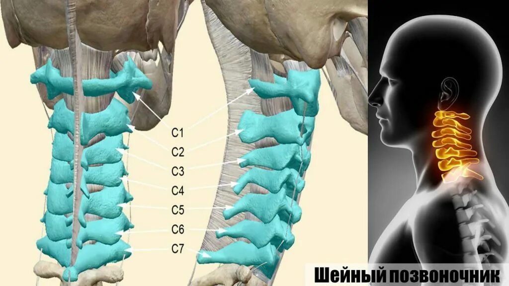 Позвоночник шейный отдел строение фото Грыжа шейного отдела позвоночника симптомы, лечение без операции в Москве