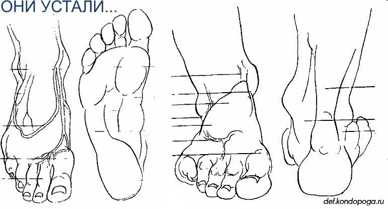 Правильная стопа человека как выглядит фото Оздоровительные системы " Страница 3
