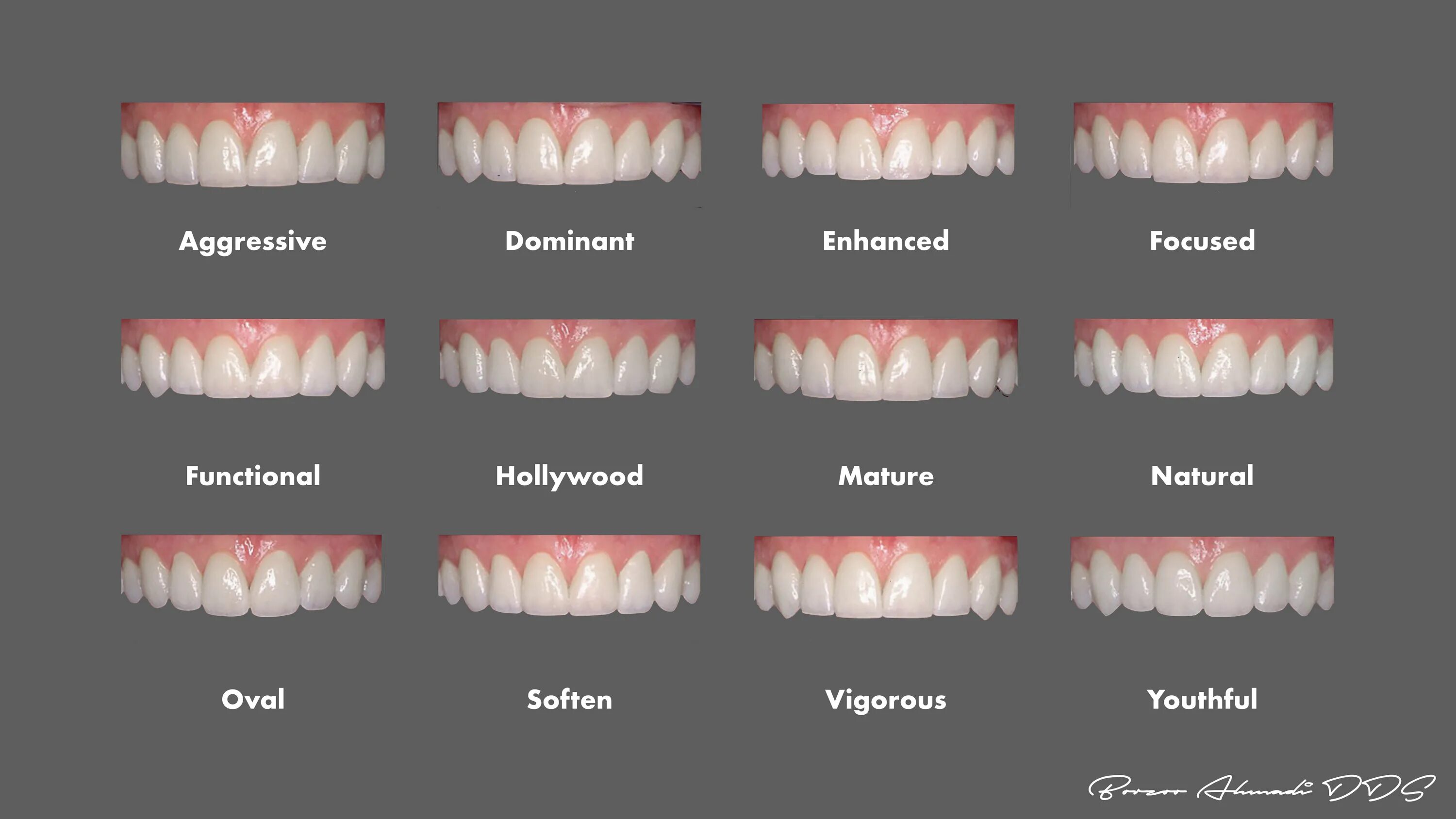 Правильные зубы у женщин как выглядят Floor has teeth: найдено 75 изображений