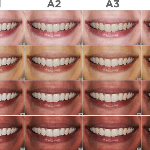 Правильные зубы у женщин как выглядят Цвет зубов b1 фото - Цвет Зубов А3 Фото Керамики У Зубов.