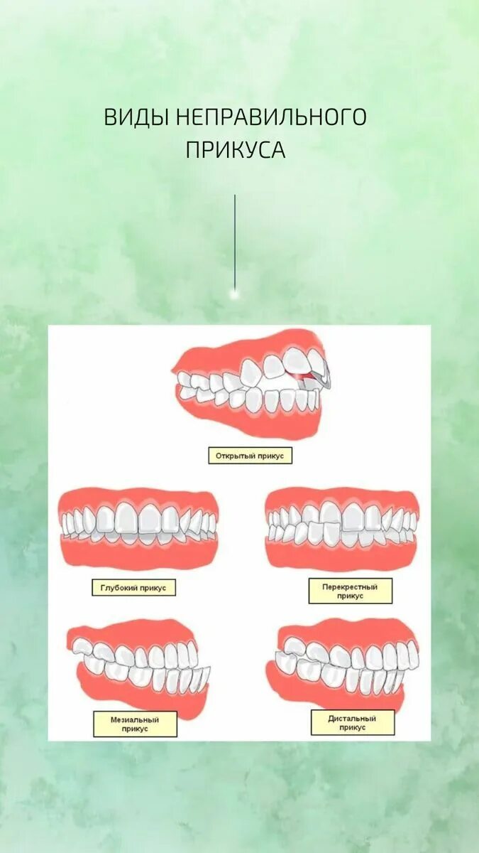 Правильный прикус у человека схема фото Будьте сами стоматологом! Вылечите кариес, десна и отбелите зубы с этой НАТУРАЛЬ