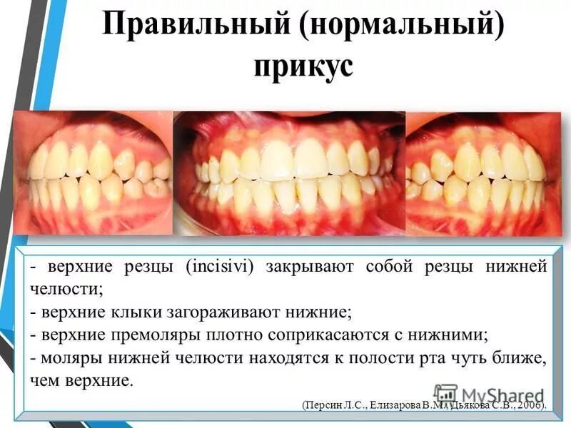 Правильный прикус у человека схема фото Правильное смыкание зубов схема