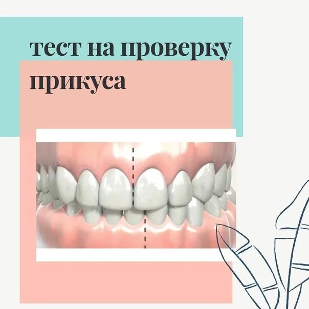 Правильный прикус зубов у человека схема фото Прикус верхней челюсти