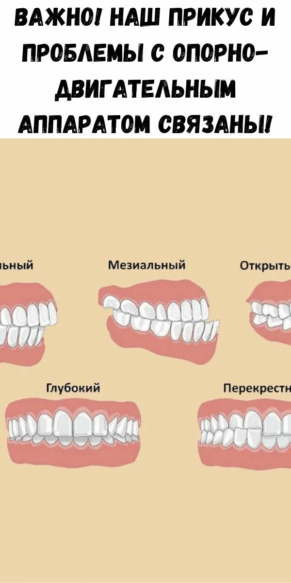 Правильный прикус зубов у человека схема фото Правильное смыкание зубов схема