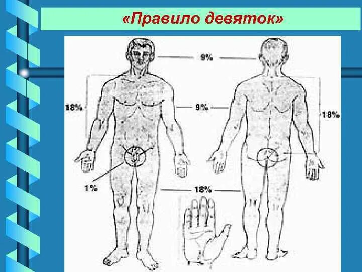 Правило 9 фото Термические поражения. Первая медицинская и доврачебная помощь.