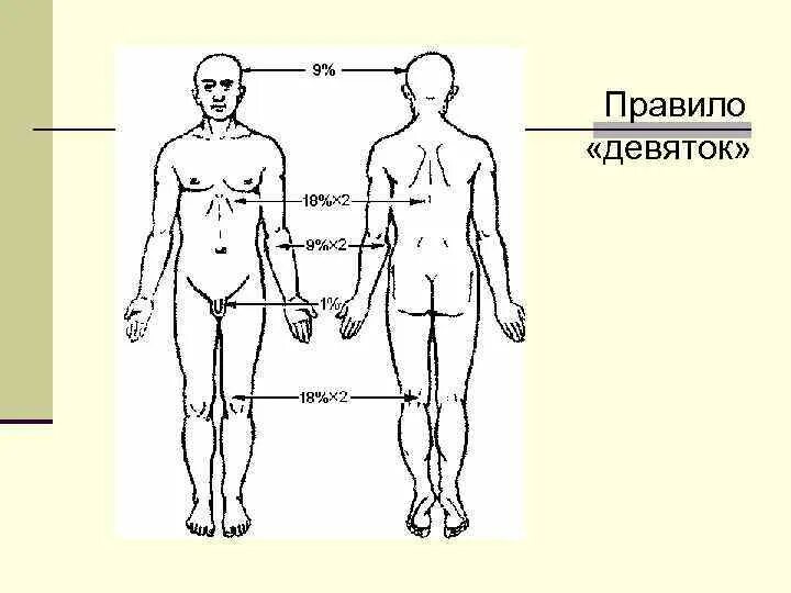 Правило 9 фото Передняя поверхность туловища по правилу девятки: найдено 89 изображений