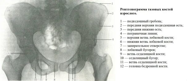 Правой подвздошной кости фото TAZ The pelvic bones (pubic, sciatic, iliac), sacrum and coccyx, joined by the s