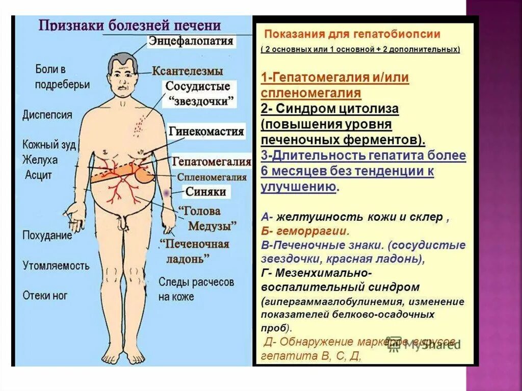 При болезнях печени на теле болезни фото Лечении болезней печени у женщин - найдено 77 картинок