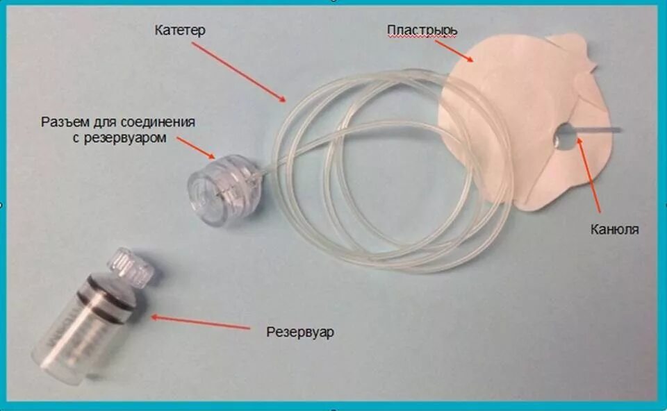 При подключении инфузионной системы к пвк необходимо Инфузионные системы для постоянной подкожной инфузии инсулина (ППИИ).