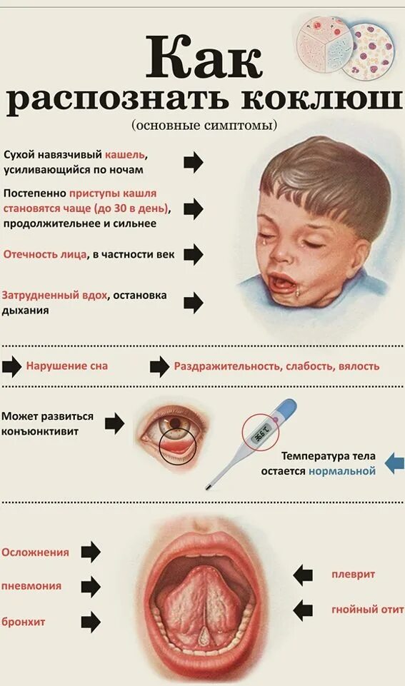 Прическа коклюш женская КАМЕНСКАЯ СРЕДНЯЯ ОБЩЕОБРАЗОВАТЕЛЬНАЯ ШКОЛА - Коклюш