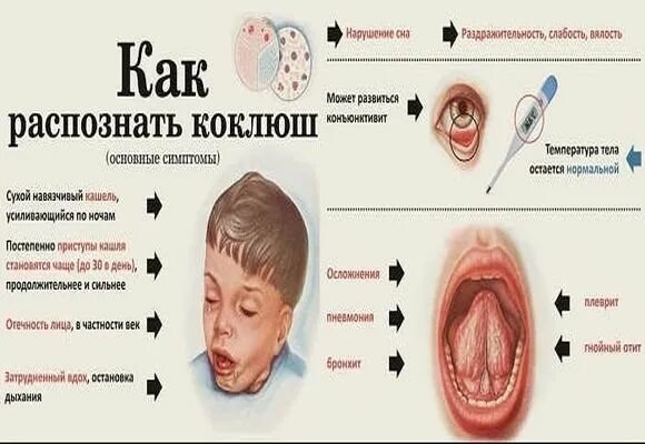 Прическа коклюш женская Коклюш, что это такое? 2022 МБДОУ - детский сад № 463 ВКонтакте