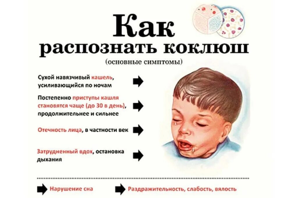 Прическа коклюш женская Как защититься от коклюша?