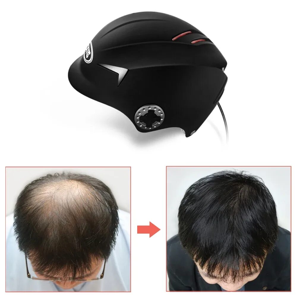 Прическа шлем мужская Hair Regrow Laser Helmet Cap Men Women Th Style Headphones - AliExpress