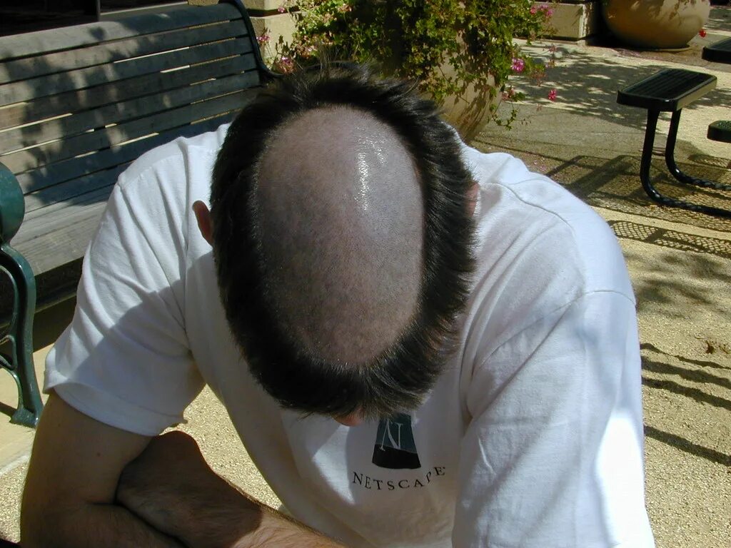 Прическа яйцо мужская Man's hair from head shaved for not paying back loan National