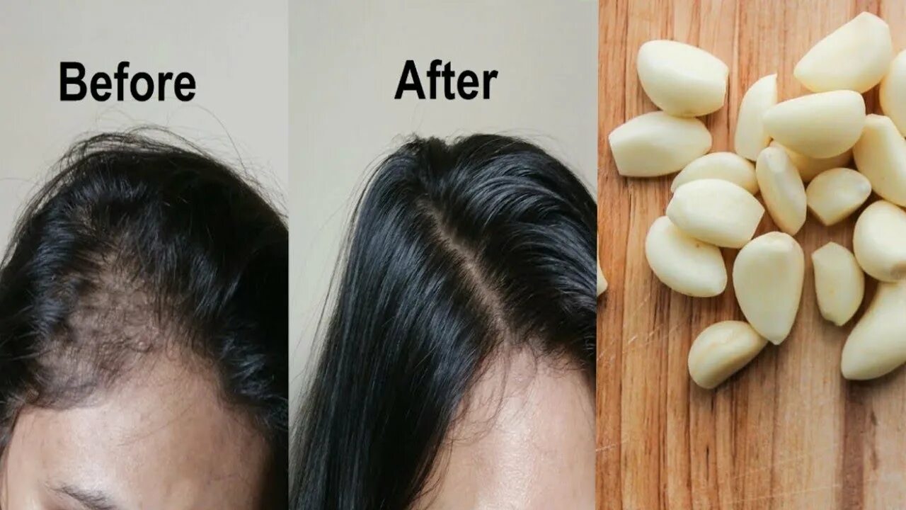 Прически для роста волос अब लहसुन से बालों को बनाये लम्बा GET THICK HAIR, LONG HAIR AND HEALTHY HAIR - Yo