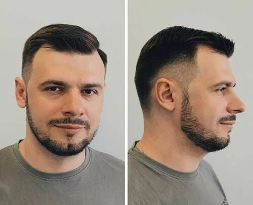 Прически мужские мало волос Access denied Haircuts for balding men, Balding mens hairstyles, Mens haircuts f