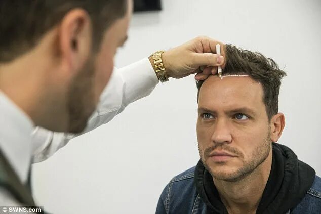 Прически на лоб мужские TOWIE's Jamie Reed proudly shows off hair transplant Daily Mail Online