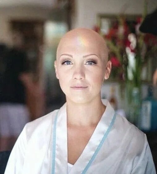 Прически после химиотерапии для женщин #hairdare #bald #smooth #headshave #closeshave #baldwoman #shavedhead #beautiful