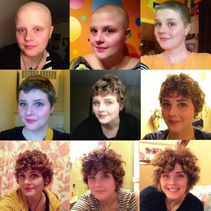 Прически растут волосы 1 year Chemo journey! - Awesome Hair growth after chemo, Growing hair after chem