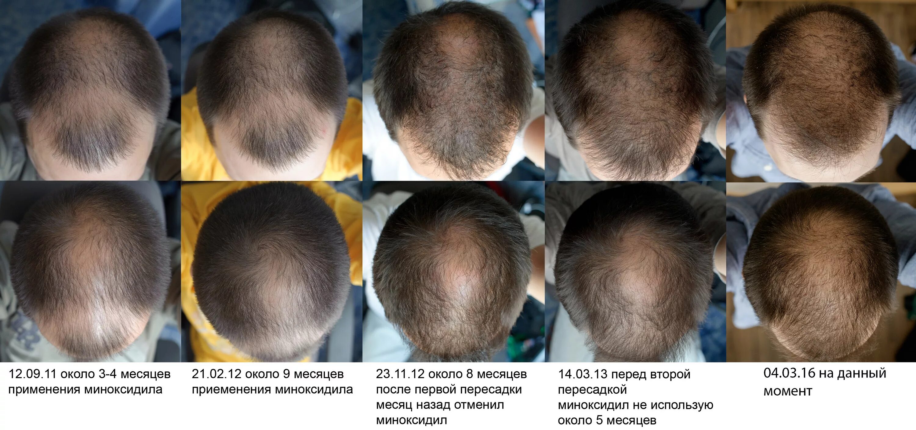 Прически растут волосы Контент фотограф - Страница 12 - Независимый форум о волосах