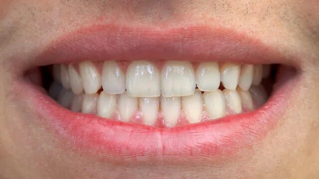 Прикус зубов фото Mouth And Teeth Изображения: просматривайте стоковые фотографии, векторные изобр