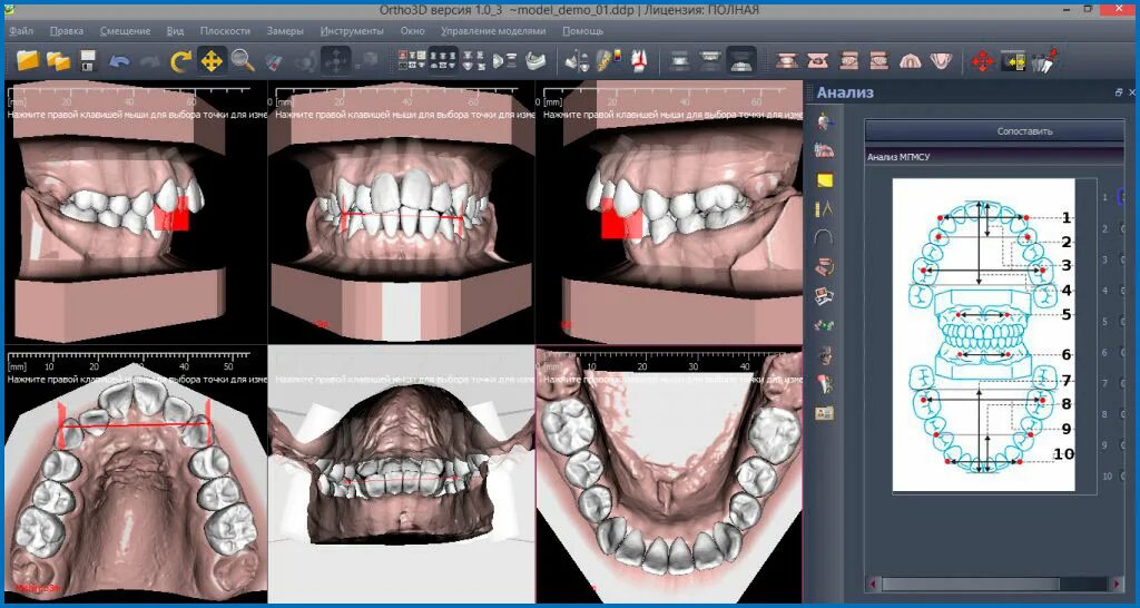 Приложение зубы на фото 3D-печать моделей с помощью cad программы