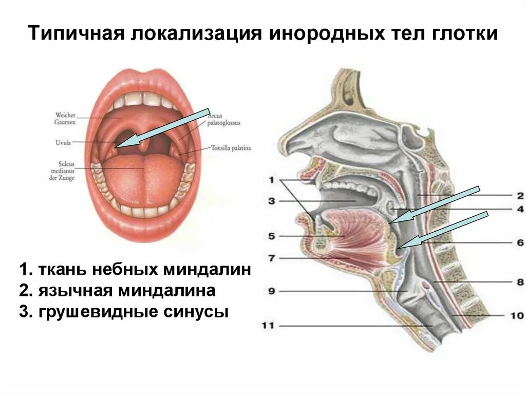 Припухлость в горле с одной стороны фото Картинки ВЕРХНЮЮ ЛЕВУЮ И ВЕРХНЮЮ ПРАВУЮ